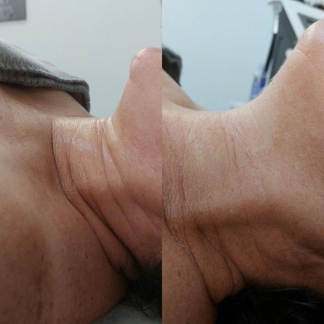 массаж та манікюр в One Shape